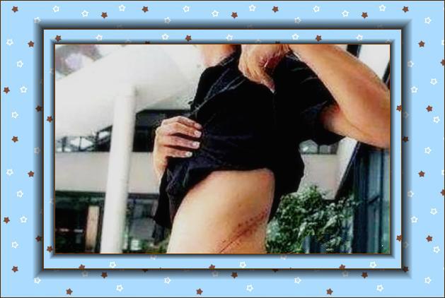 当年用肾换苹果手机的人后续,当初用肾换苹果的人怎么样了