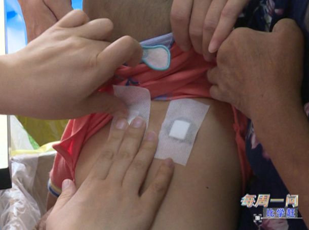 每周一问比学赶｜区卫计局：加强技术引进助力中医药事业发展