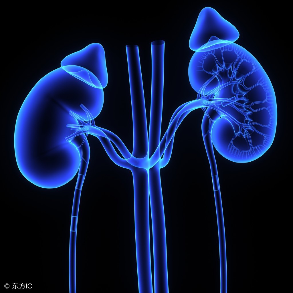 82岁老人肾内长巨石！如何将巨型结石一次性清理干净