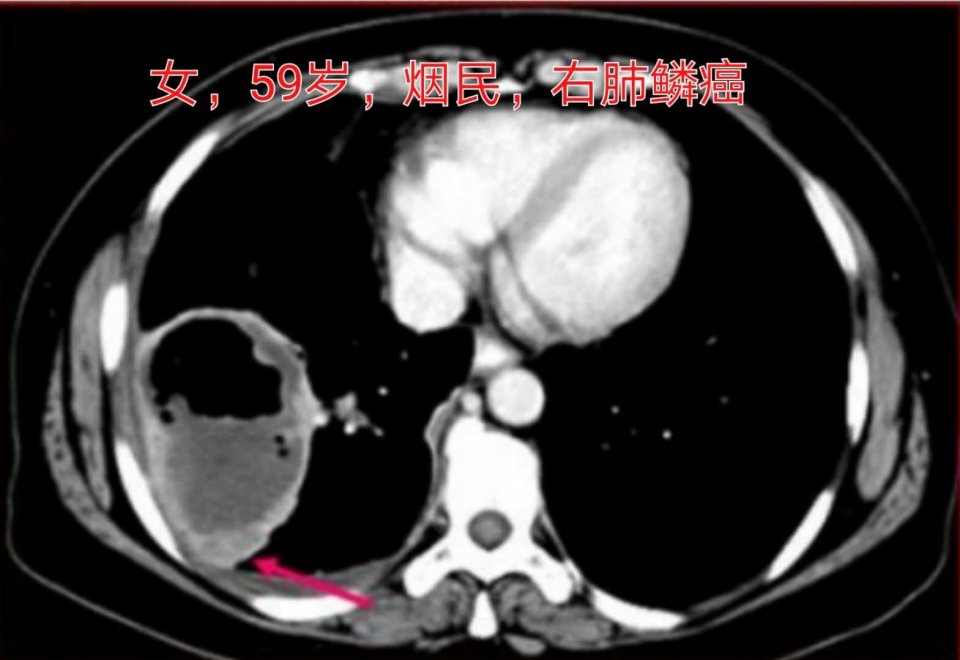 长寿的原因跟抽烟喝酒运动无关,为什么有人又抽烟又喝酒却能长寿