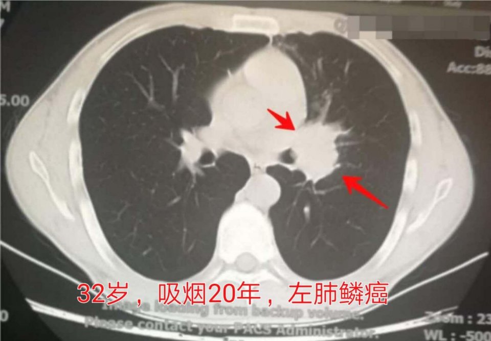 长寿的原因跟抽烟喝酒运动无关,为什么有人又抽烟又喝酒却能长寿