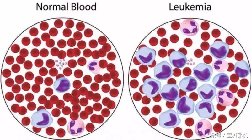 我不是药神德国格列宁,我不是药神格列宁多少一瓶