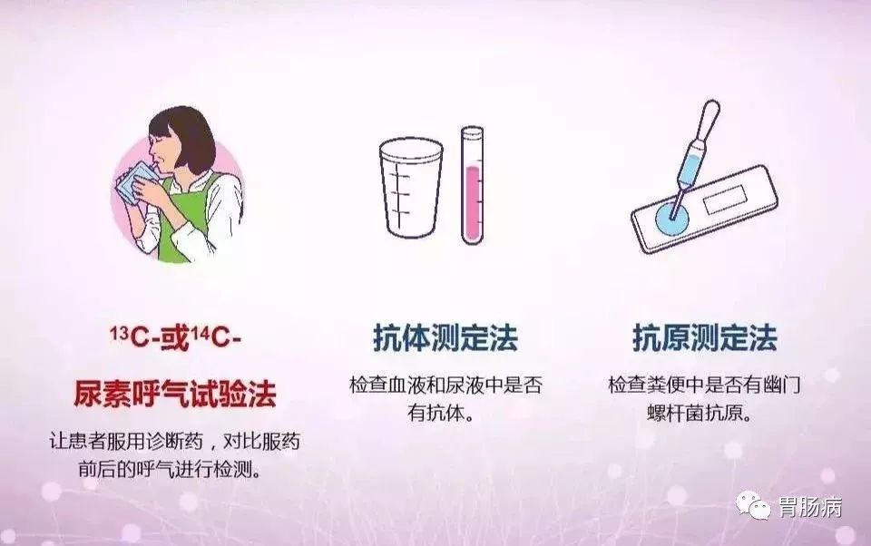 幽门螺杆菌HP什么意思,hp幽门螺杆菌的症状