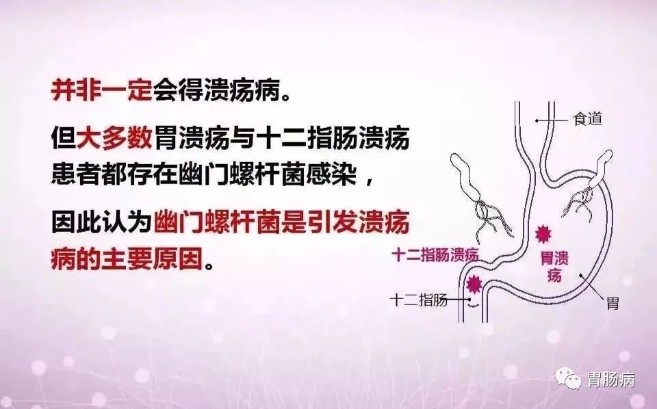 幽门螺杆菌HP什么意思,hp幽门螺杆菌的症状