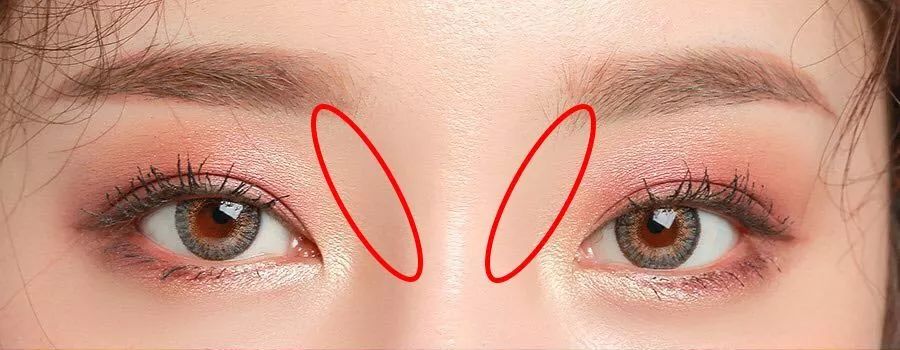 鼻梁塌的自然整鼻,想要高鼻梁三步教你告别塌鼻子