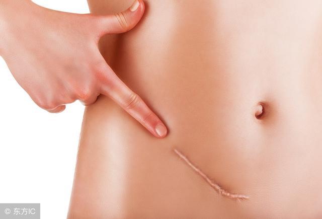 宫颈囊肿糜烂肥大影响怀孕吗,宫颈肥大影响排小便吗