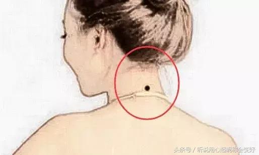 人身上的四大恶痣，不能留，贪婪自私，福缘浅薄，一生坎坷！