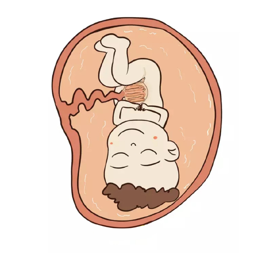 孕晚期准妈妈的产前注意事项,孕早期准妈妈要做的事