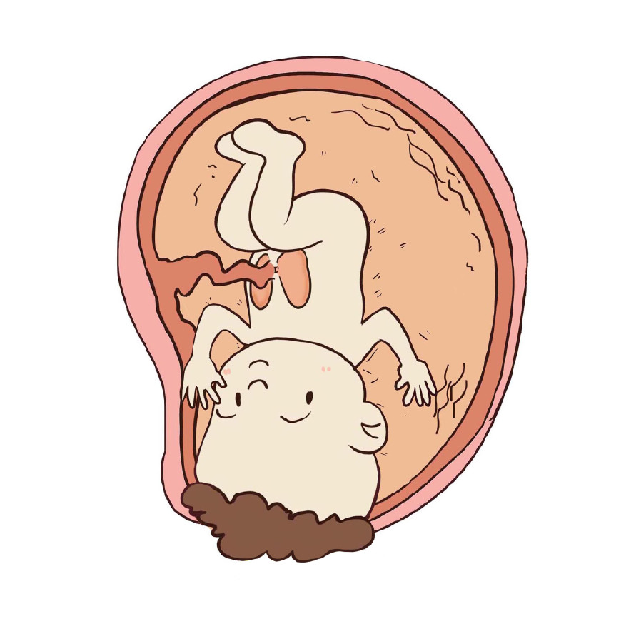 孕晚期准妈妈的产前注意事项,孕早期准妈妈要做的事