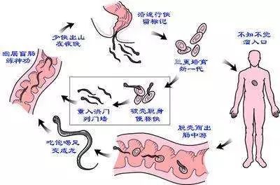 6岁娃喊“屁屁疼”,医生扒下孩子裤子惊呆:白色小虫在蠕动!
