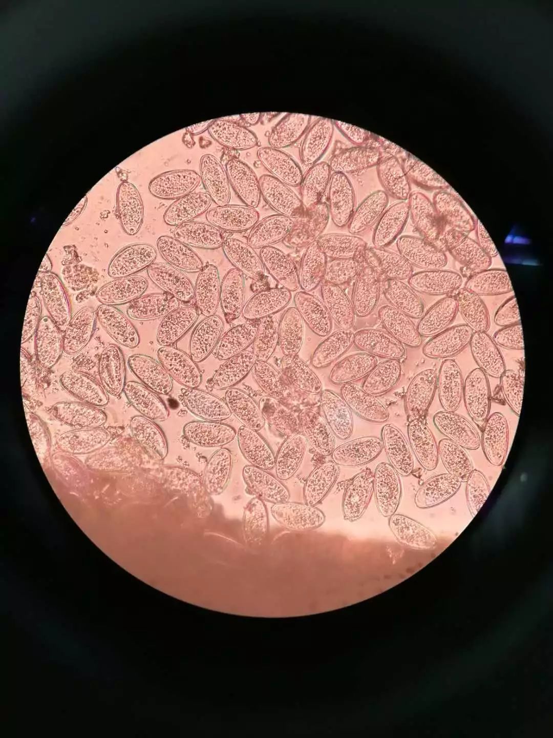 6岁娃喊“屁屁疼”,医生扒下孩子裤子惊呆:白色小虫在蠕动!