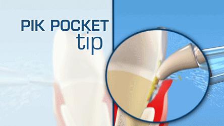 冲牙器改善牙龈出血,超声波冲牙器清洁牙垢是否有效果