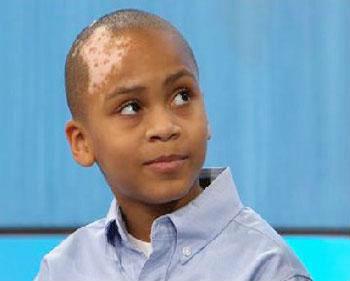 邯郸哪里有看白癜风的老中医,白癜风好转的迹象图片