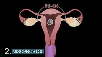 一组动图警示你,一组动图警示你绝望的操作