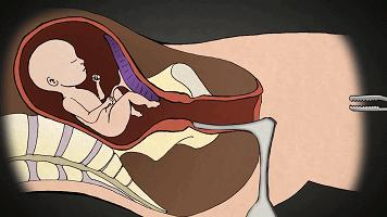 一组动图警示你,一组动图警示你绝望的操作