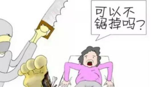 都有哪些便捷的糖尿病足诊断方法,糖尿病足怎么在家进行足部检查