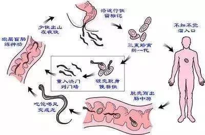 6岁男孩喊“屁屁疼”！医生扒下裤子一看，竟有白色小虫在蠕动……