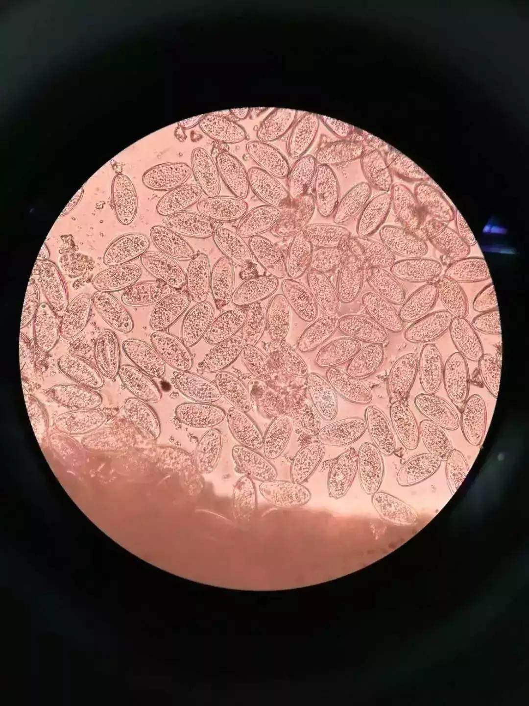 6岁男孩喊“屁屁疼”！医生扒下裤子一看，竟有白色小虫在蠕动……