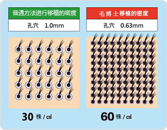 头发是怎么种出来的,种头发能和原来头发一样吗