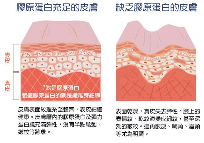 治痘痘避免日光和紫外线照射,研究紫外线对痘痘的影响