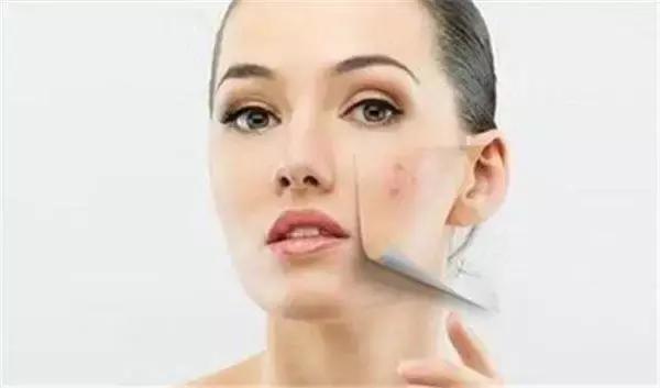 可怕!她把痔疮膏当眼霜涂了以后……差点儿毁容了!