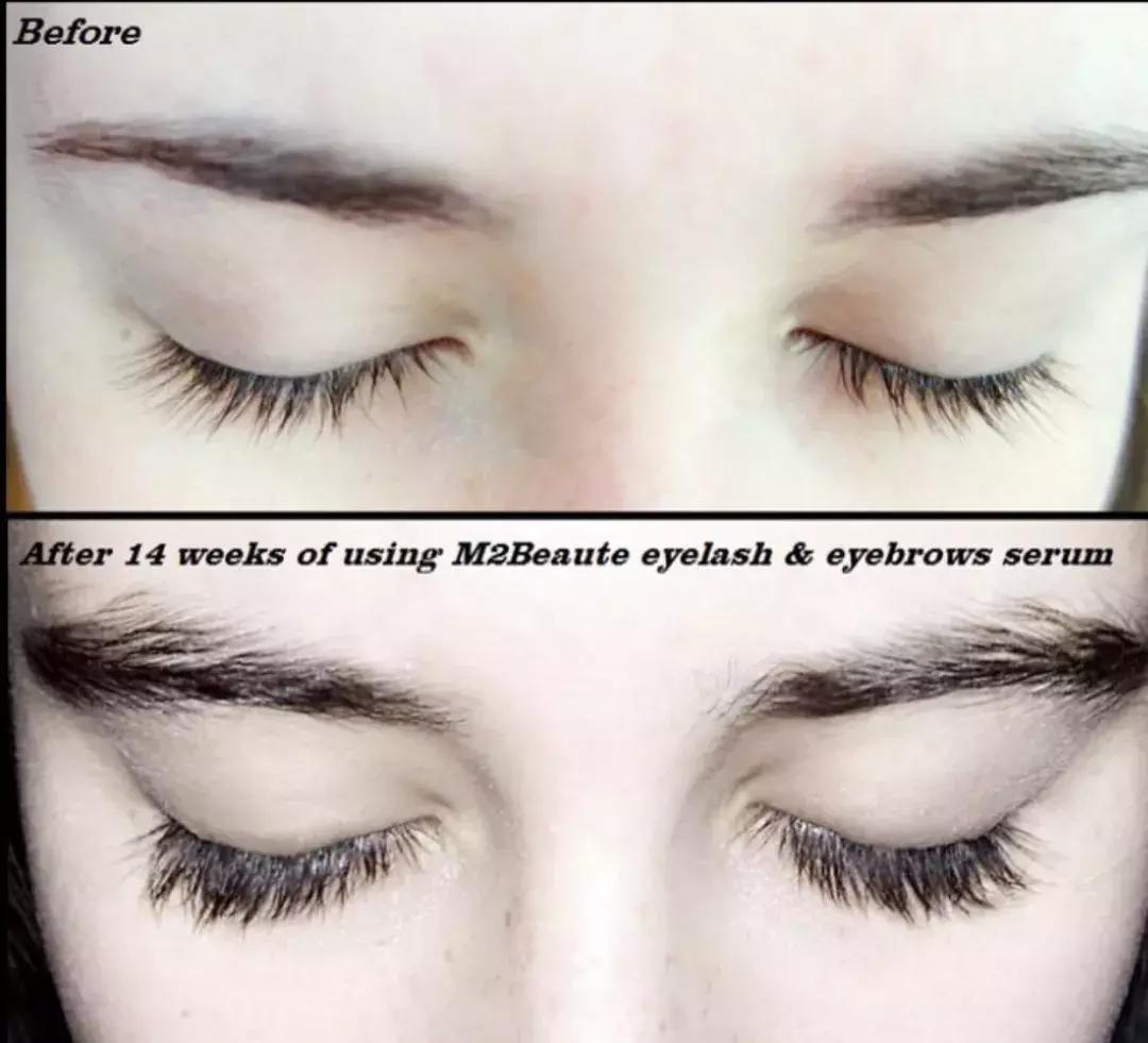 刘嘉玲用的面霜,刘嘉玲代言的面霜