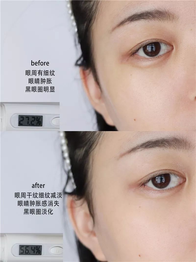 2周!黑眼圈没了、眼纹也淡了这个“眼周小熨斗”让眼睛年轻了10岁不止!
