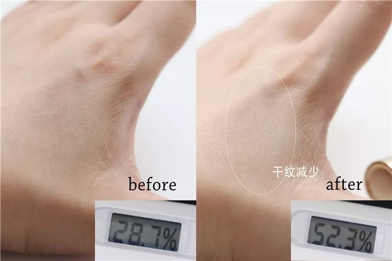 2周!黑眼圈没了、眼纹也淡了这个“眼周小熨斗”让眼睛年轻了10岁不止!