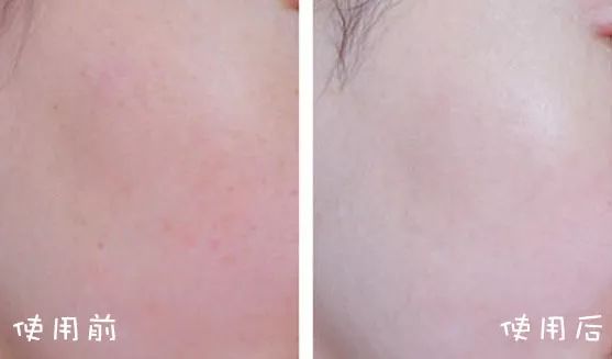 断货半年，抢都抢不到！荣登Cosme榜首，用完肌肤嫩到爆