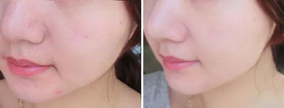 断货半年，抢都抢不到！荣登Cosme榜首，用完肌肤嫩到爆