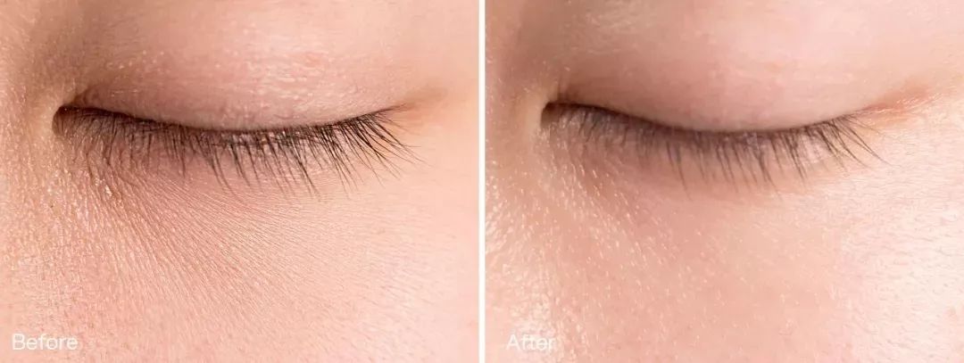 2周！黑眼圈没了、眼纹也淡了这个“眼周小熨斗”让眼睛年轻了10岁不止！