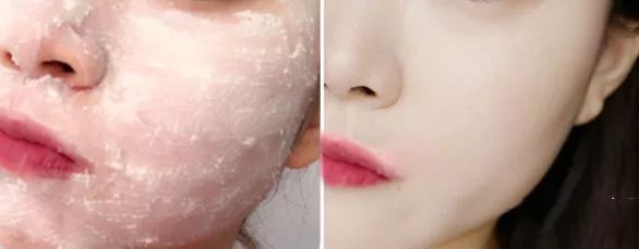 断货半年，抢都抢不到！荣登Cosme榜首，用完肌肤嫩到爆