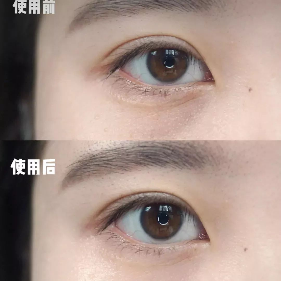 2周!黑眼圈没了、眼纹也淡了这个“眼周小熨斗”让眼睛年轻了10岁不止!