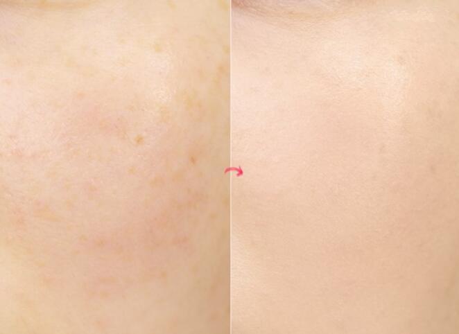 兰蔻持久粉底液氧化测评,兰蔻持妆粉底液真实测评混干