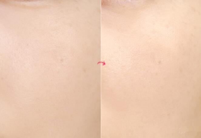 雅诗兰黛沁水粉底液夏天适合用吗,雅诗兰黛粉底液适合秋冬天吗