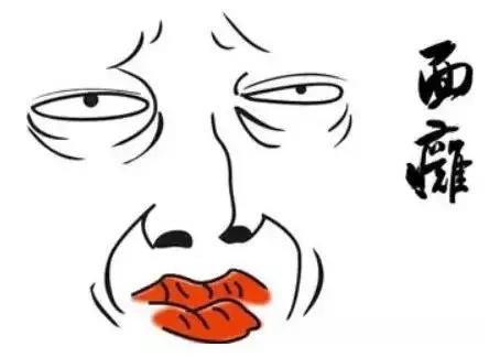 面瘫症状前兆9大表现,儿童面瘫早期症状