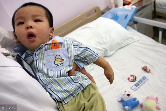 小儿脑性瘫痪最明显的表现是什么,儿童患有脑性瘫痪