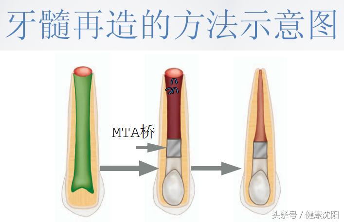 健康科普牙科,健康科普口腔科普