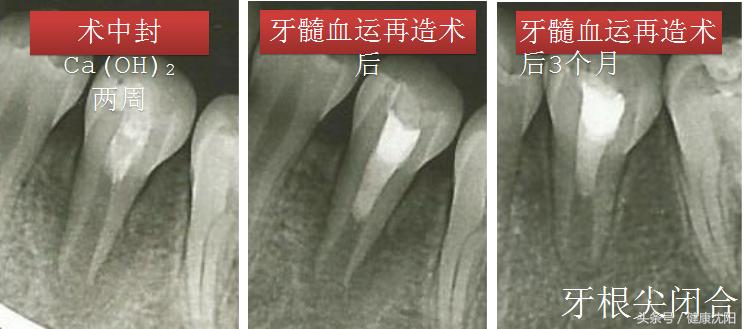 健康科普牙科,健康科普口腔科普
