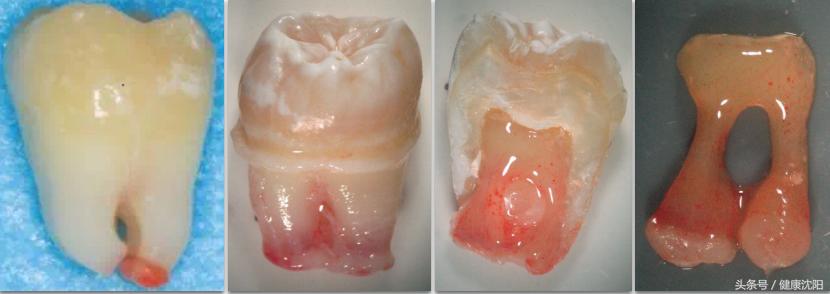 健康科普牙科,健康科普口腔科普