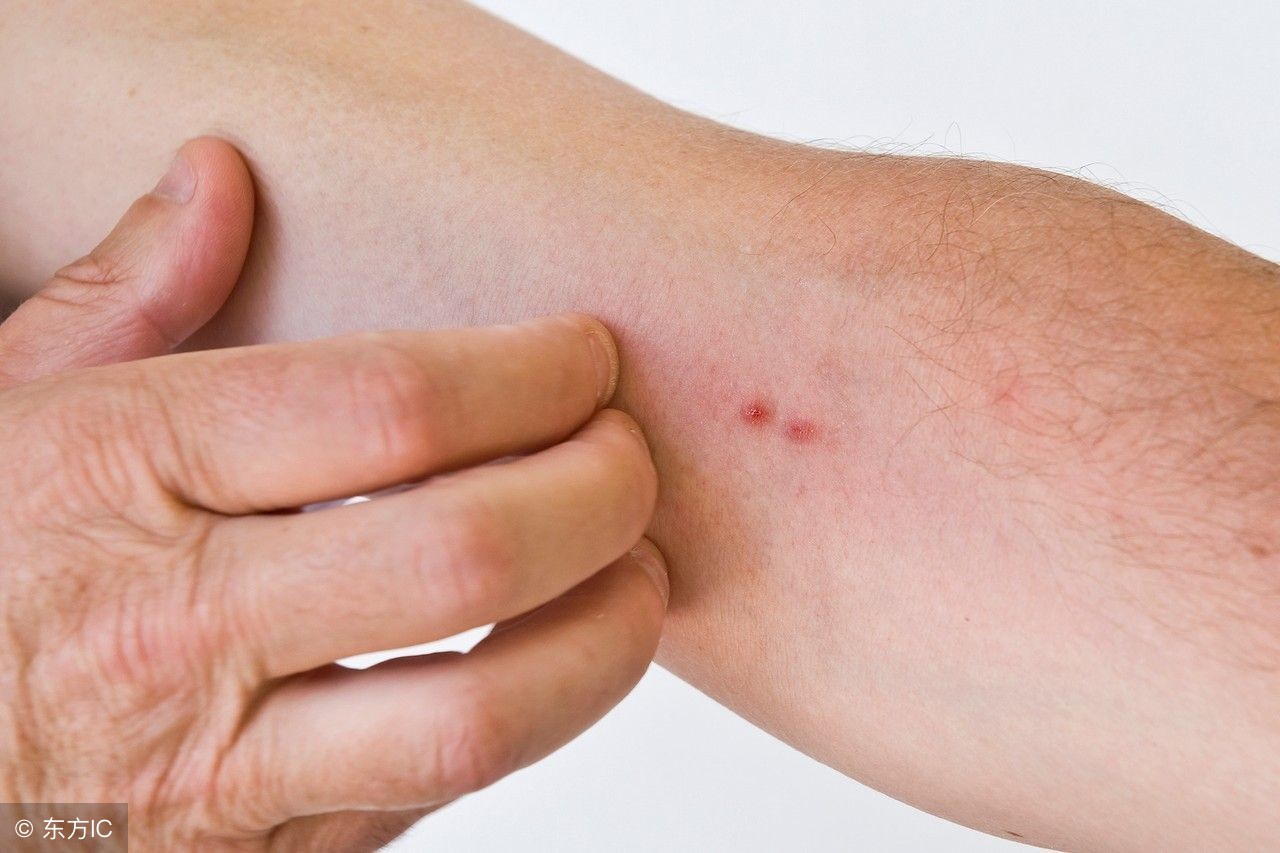 风油精孕妇可以用吗?它还有哪些不为人知的用途?