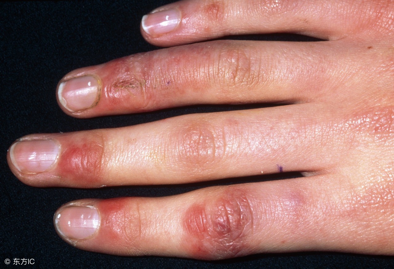 风油精孕妇可以用吗?它还有哪些不为人知的用途?