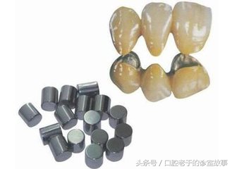 烤瓷冠什么样的最好,烤瓷冠大概多少钱一颗