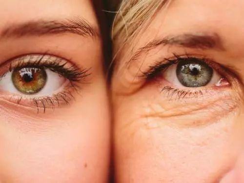 下眼袋的细纹比较多怎么救,眼袋每天怎样按摩