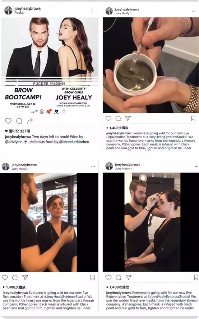 下眼袋的细纹比较多怎么救,眼袋每天怎样按摩