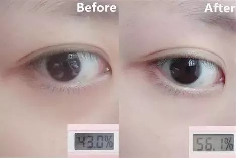 下眼袋的细纹比较多怎么救,眼袋每天怎样按摩