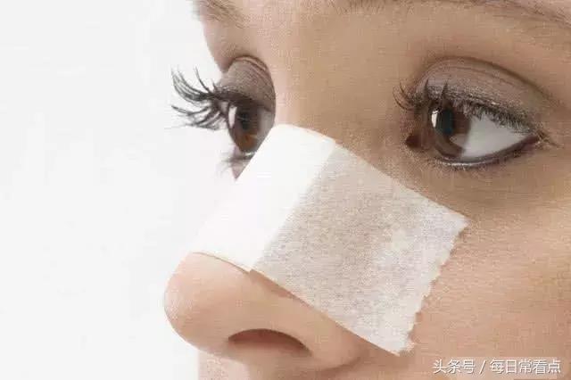 鼻子毛孔大黑头去除小妙招,鼻子毛孔粗大鼻周发红怎么改善