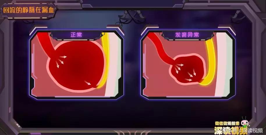 谁让你“兄弟”不给力,谁让你“痿”靡不振?阳痿真凶都在这啦!