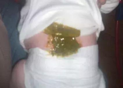 宝宝腹泻能吃什么,宝宝腹泻可以吃点什么辅食