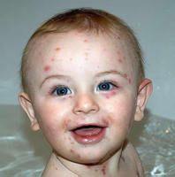 中暑的预防和急救知识课件,工地中暑预防与急救措施